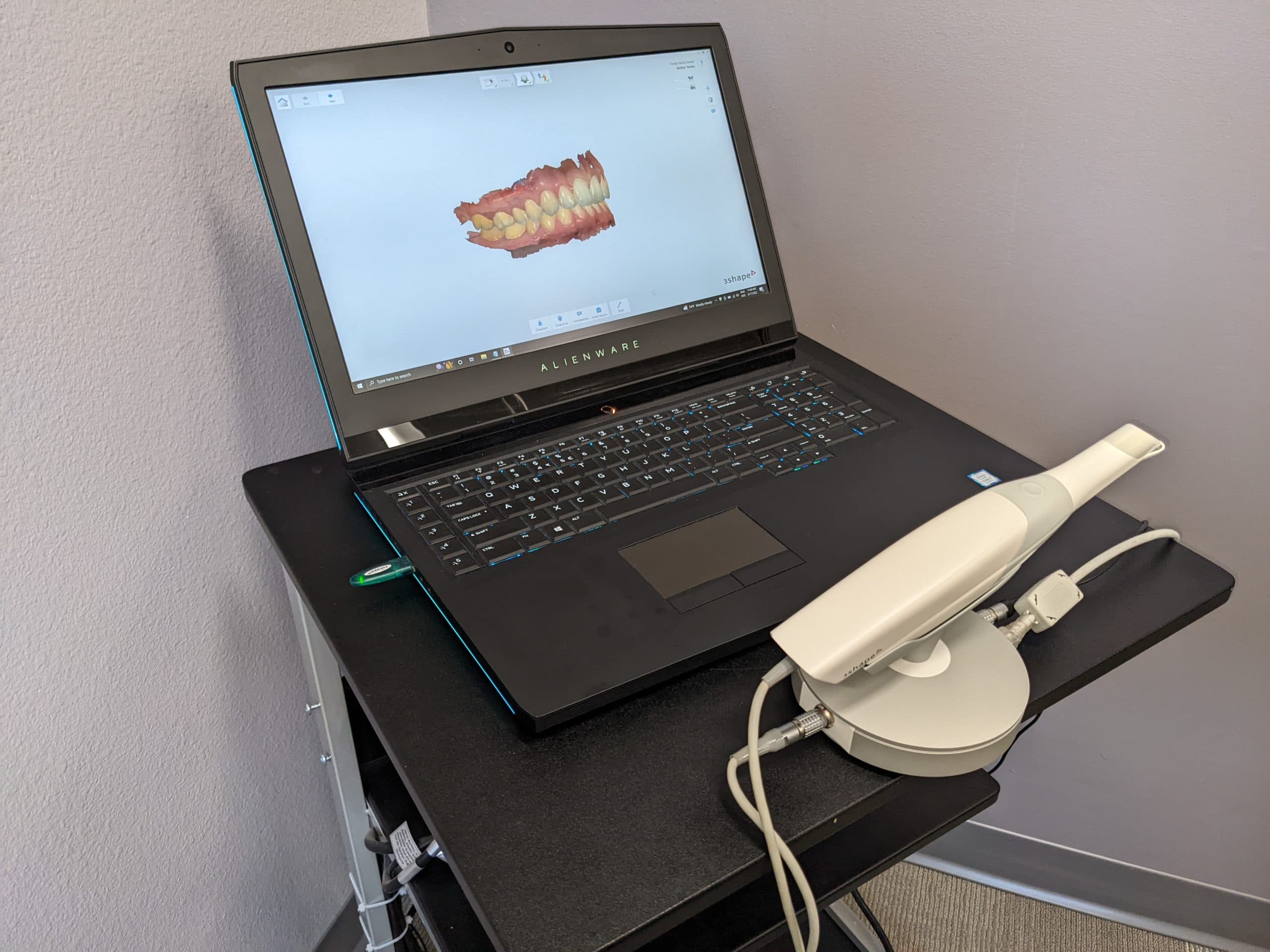 Dental Technology 3D Scanner
